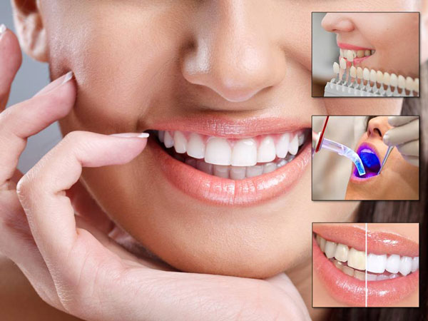 Best Dentist In Rohini - All Dental Treatments, Teeth Straigntning