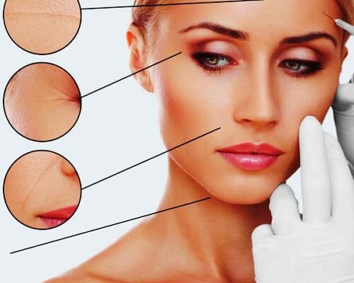 Botox - Derma Filler